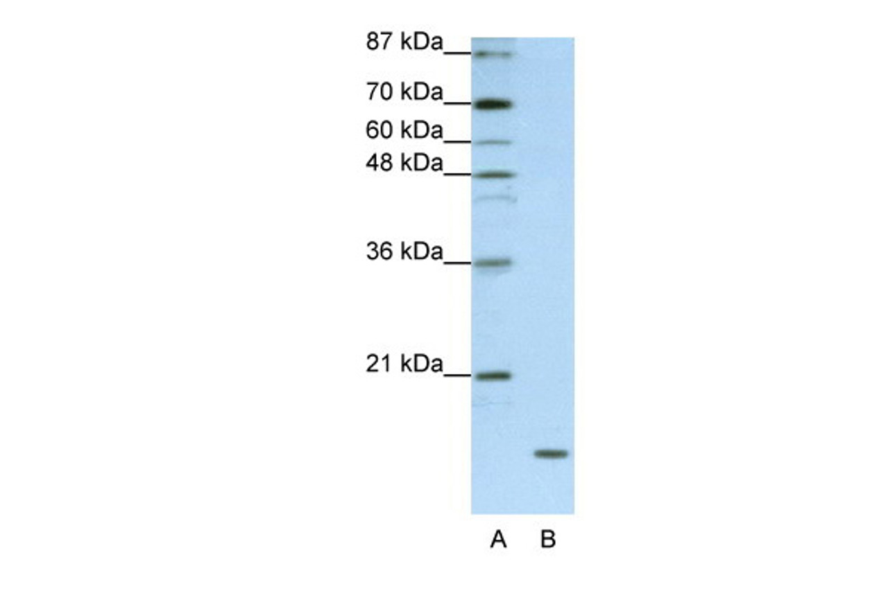 Antibody used in WB on Human HepG2 at 1.25 ug/ml.