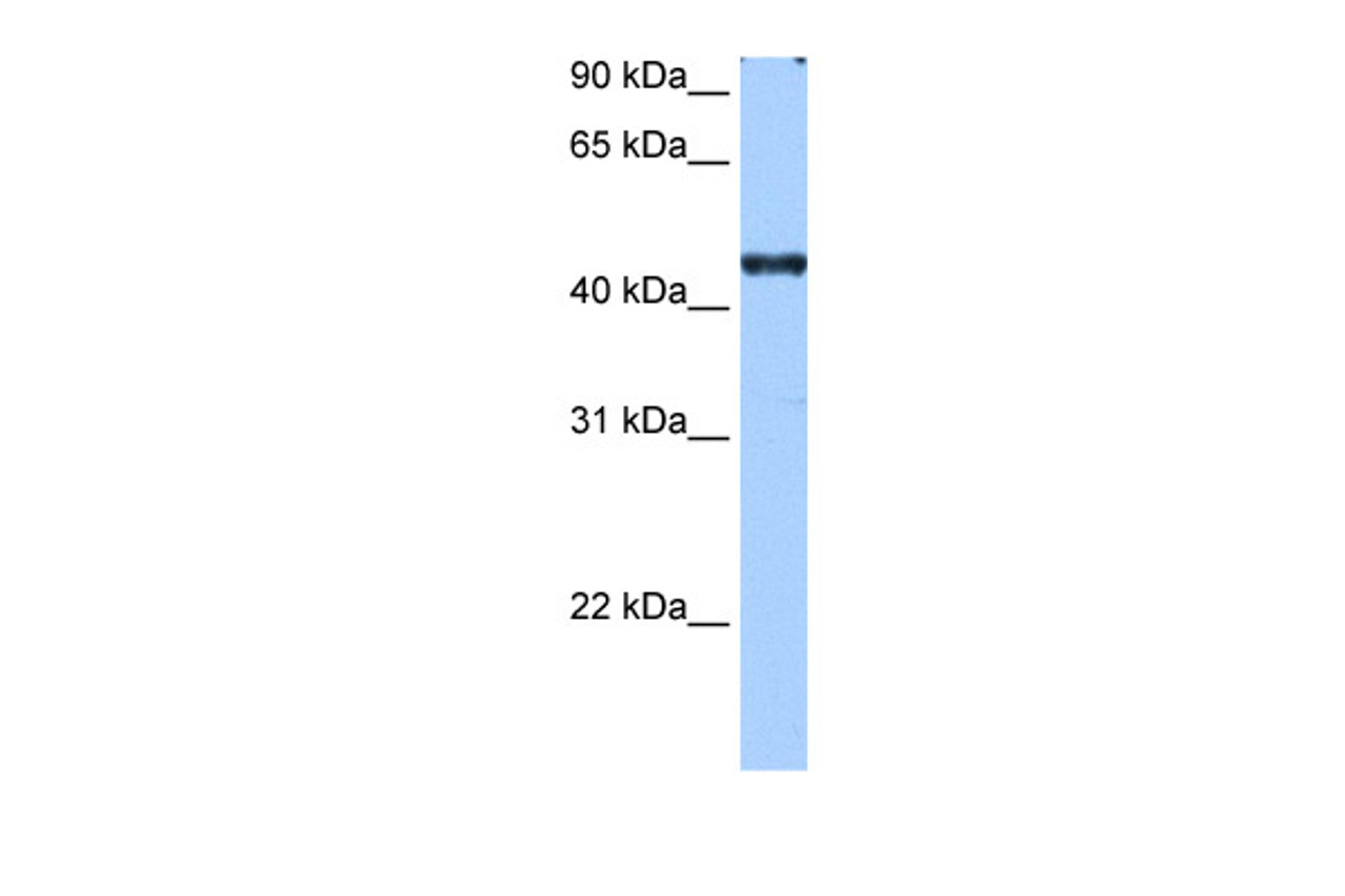 Antibody used in WB on Human HepG2 at 0.2-1 ug/ml.