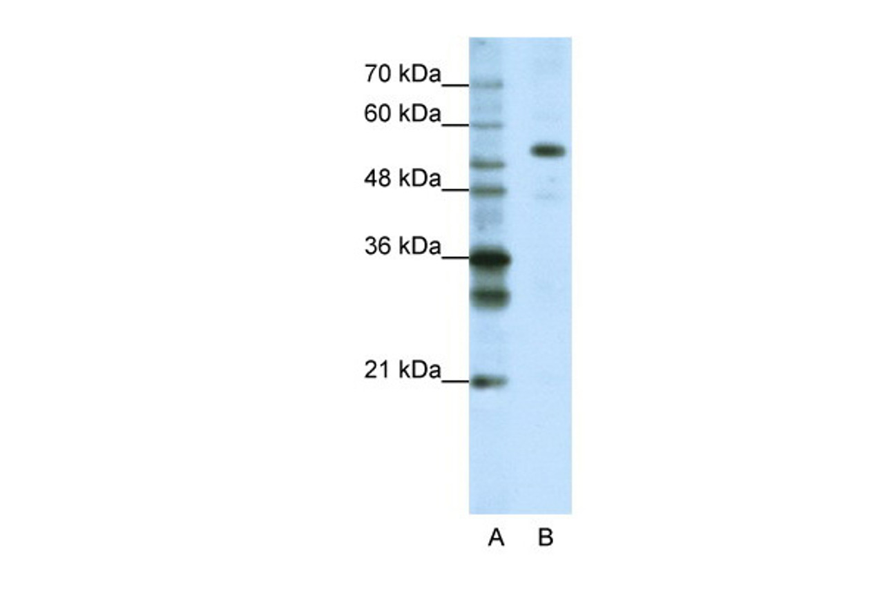 Antibody used in WB on Human HepG2 at 1.25 ug/ml.