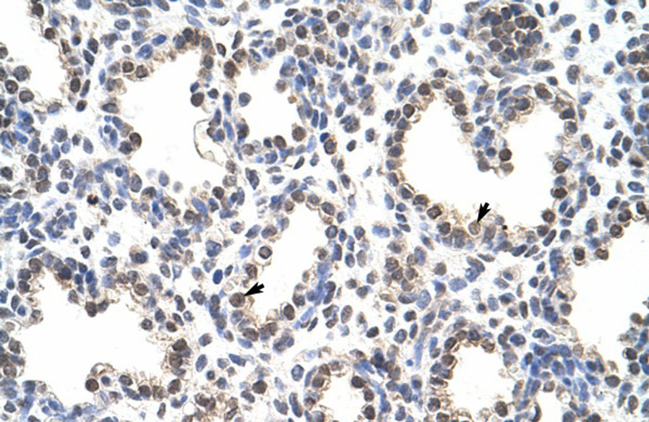 Antibody used in IHC on Human Lung at 4.0-8.0 ug/ml.