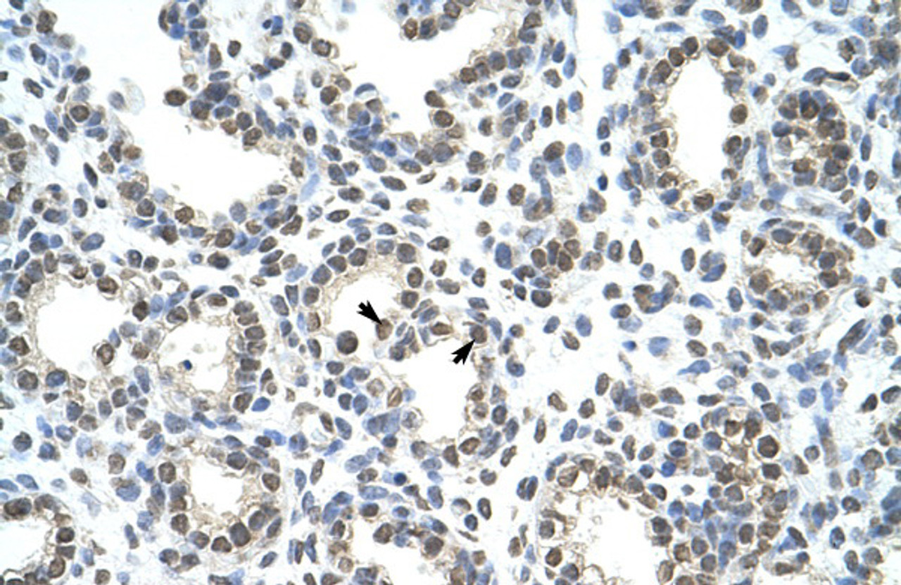 Antibody used in IHC on Human Lung at 4.0-8.0 ug/ml.