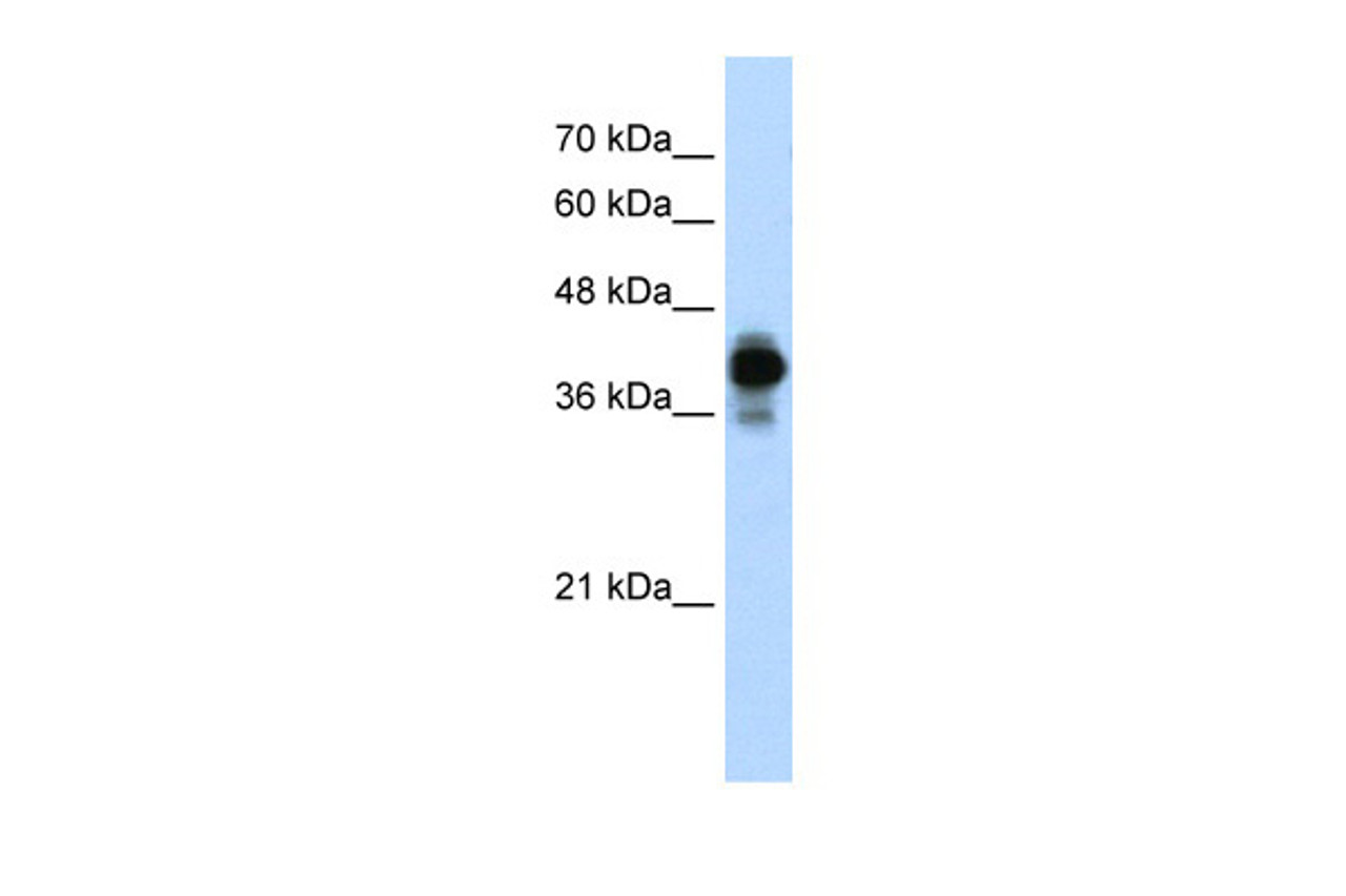 Antibody used in WB on Human Jurkat cells at 0.2-1 ug/ml.