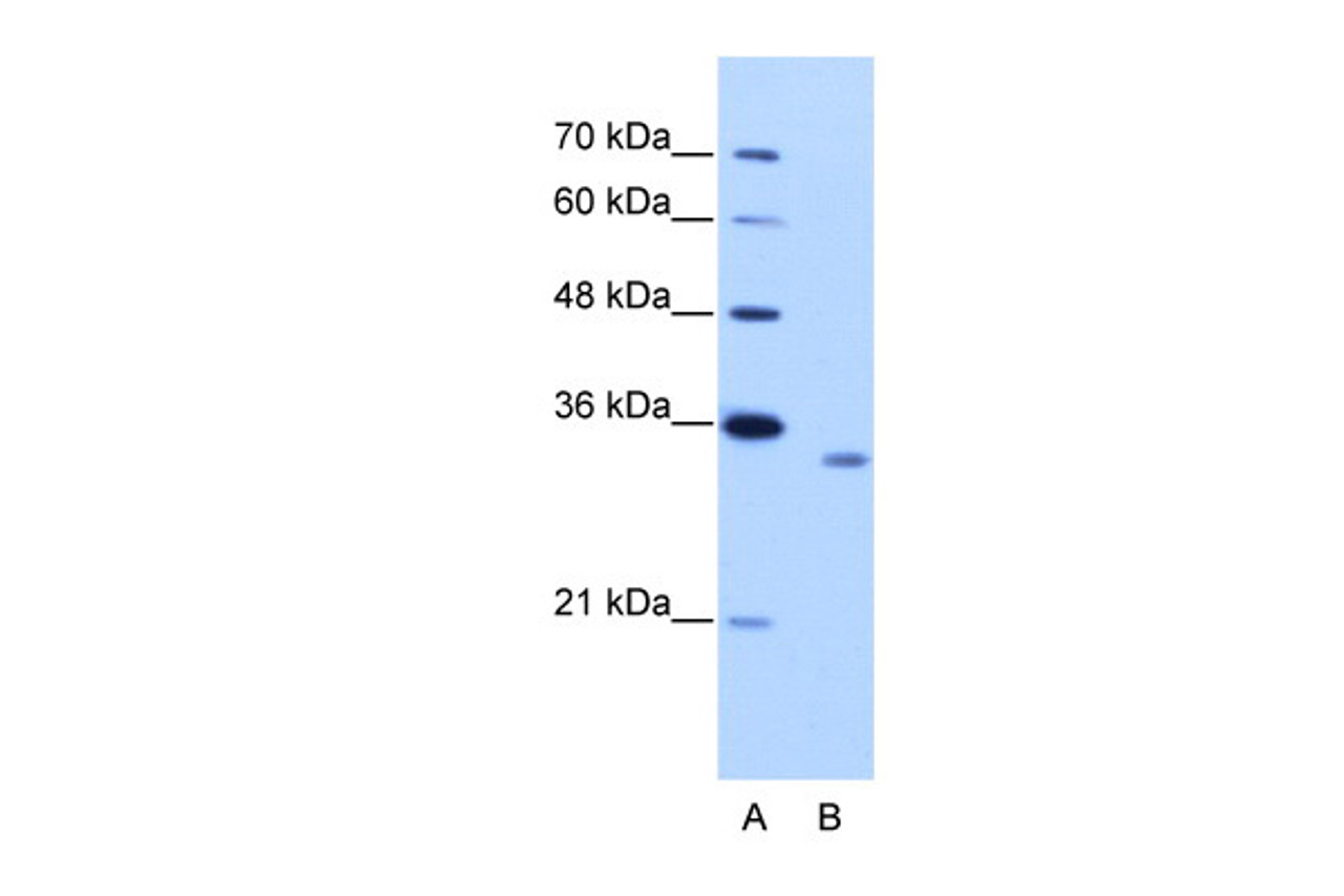 Antibody used in WB on Human Jurkat 2.5 ug/ml.