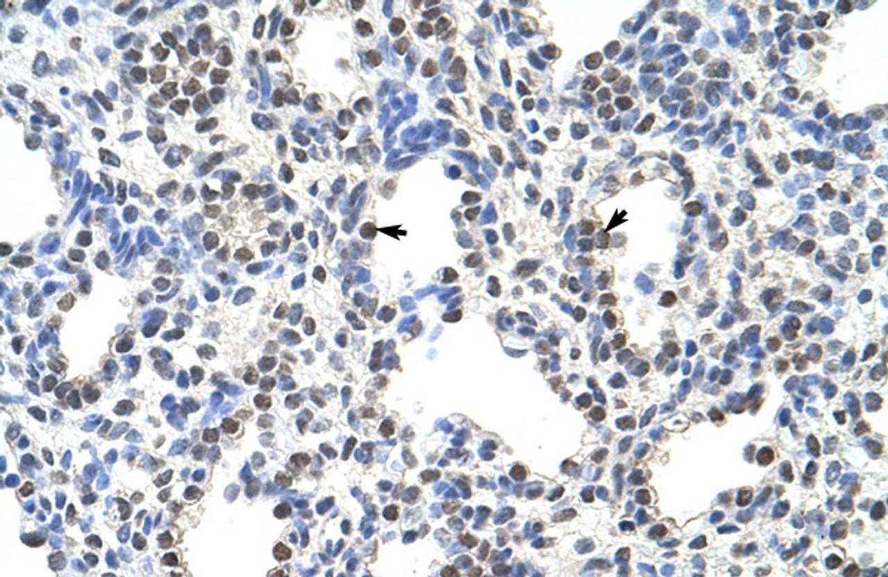 Antibody used in IHC on Human Lung at 4.0-8.0 ug/ml.