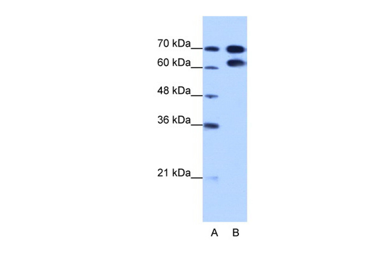 Antibody used in WB on Human HepG2 at 1.25 ug/ml.