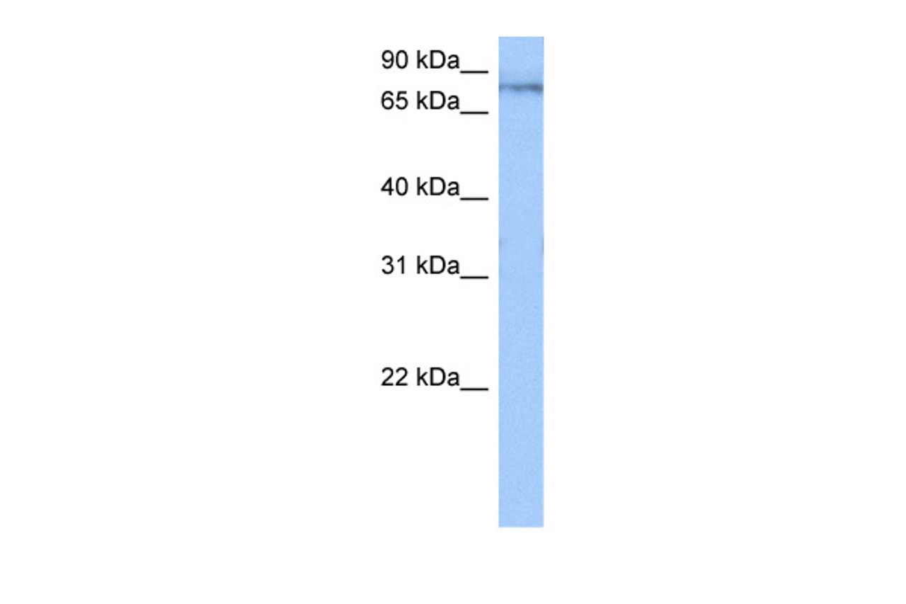 Antibody used in WB on Human Jurkat 0.2-1 ug/ml.