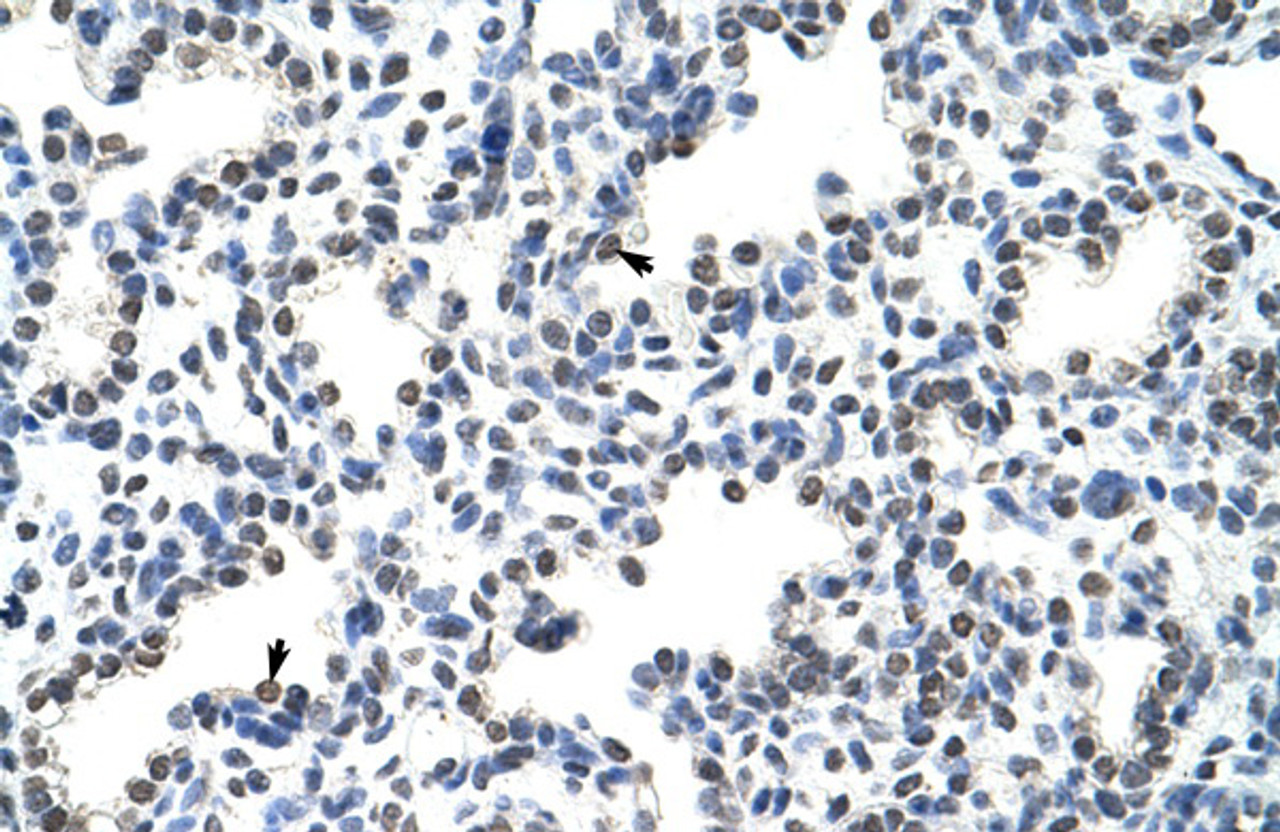 Antibody used in IHC on Human lung at 4.0-8.0 ug/ml.