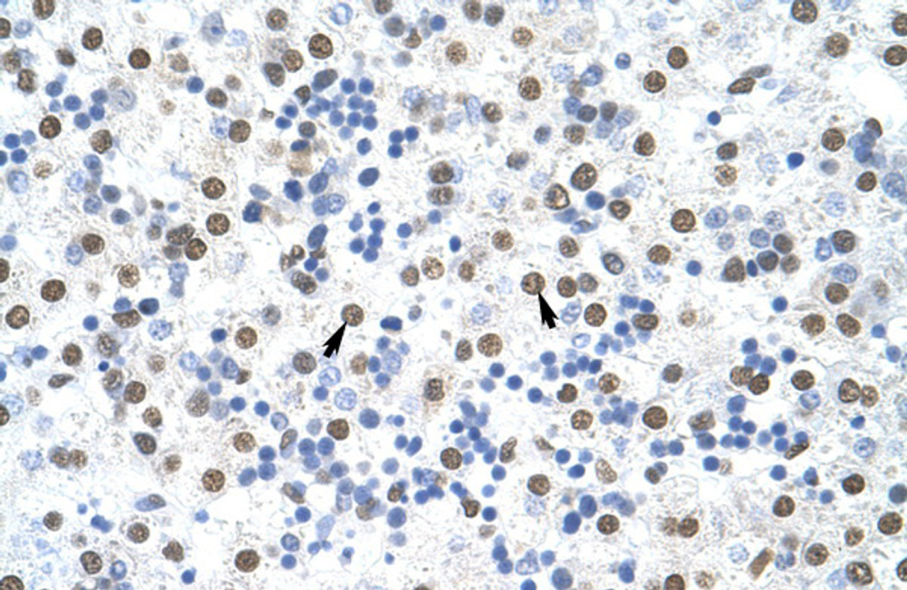 Antibody used in IHC on Human Liver at 4.0-8.0 ug/ml.