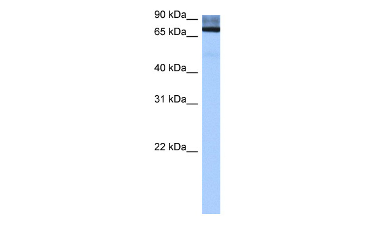 Antibody used in WB on Human Liver at 0.2-1 ug/ml.