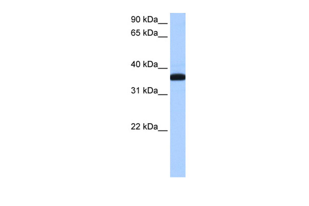 Antibody used in WB on Human MCF-7 at 0.2-1 ug/ml.