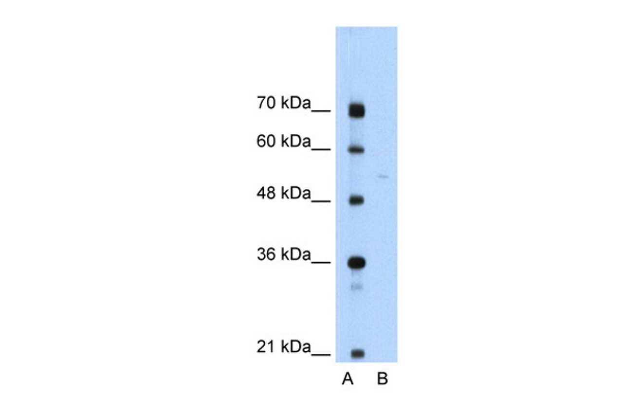 Antibody used in WB on Human Jurkat 0.2-1 ug/ml.