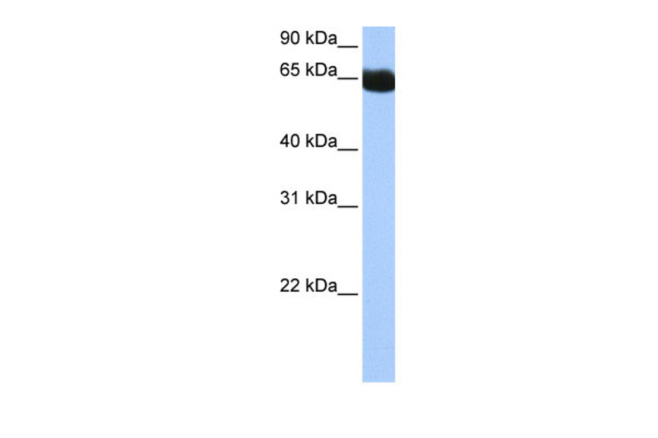 Antibody used in WB on Human Muscle at 0.2-1 ug/ml.