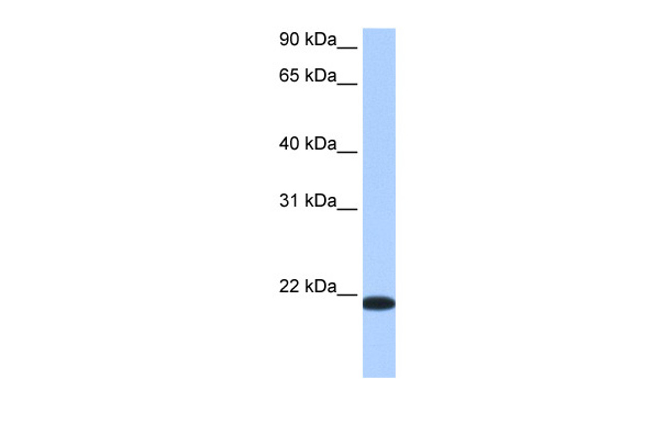 Antibody used in WB on Human Liver at 0.2-1 ug/ml.