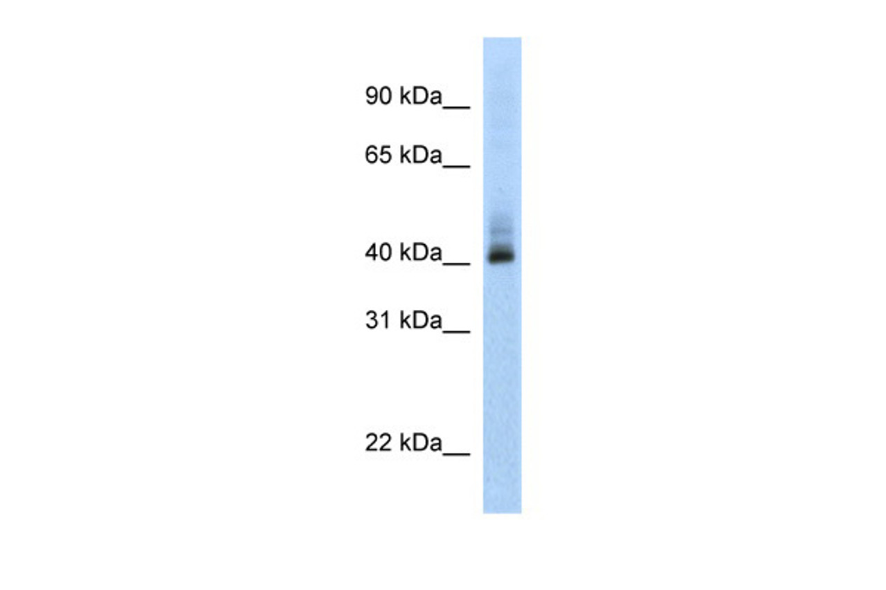 Antibody used in WB on Human MCF-7 at 0.2-1 ug/ml.