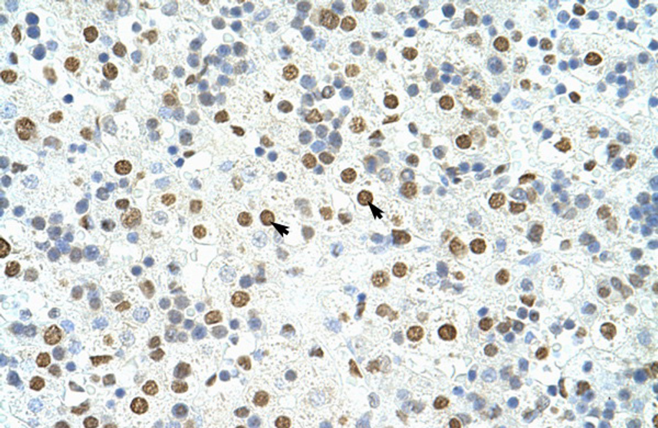 Antibody used in IHC on Human Liver at 4.0-8.0 ug/ml.