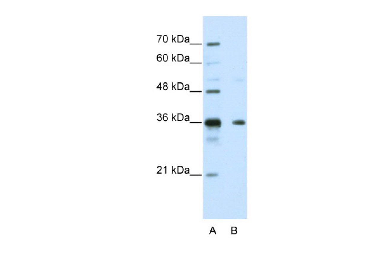 Antibody used in WB on Human HepG2 at 5.0 ug/ml.