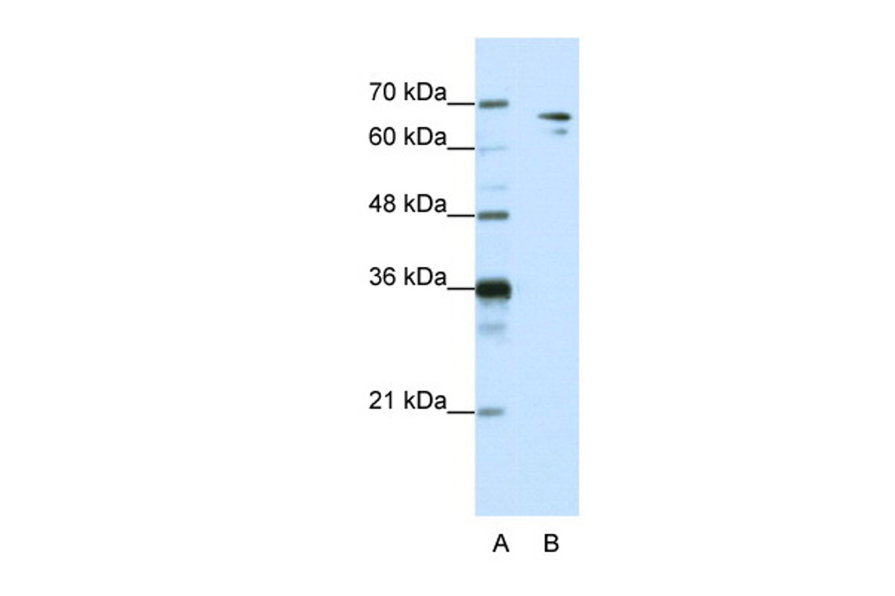 Antibody used in WB on Human HepG2 at 1.25 ug/ml.