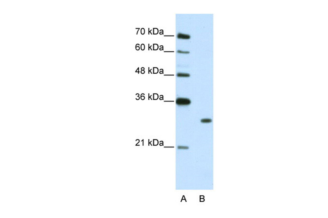 Antibody used in WB on Human Jurkat cells at 2.5 ug/ml.