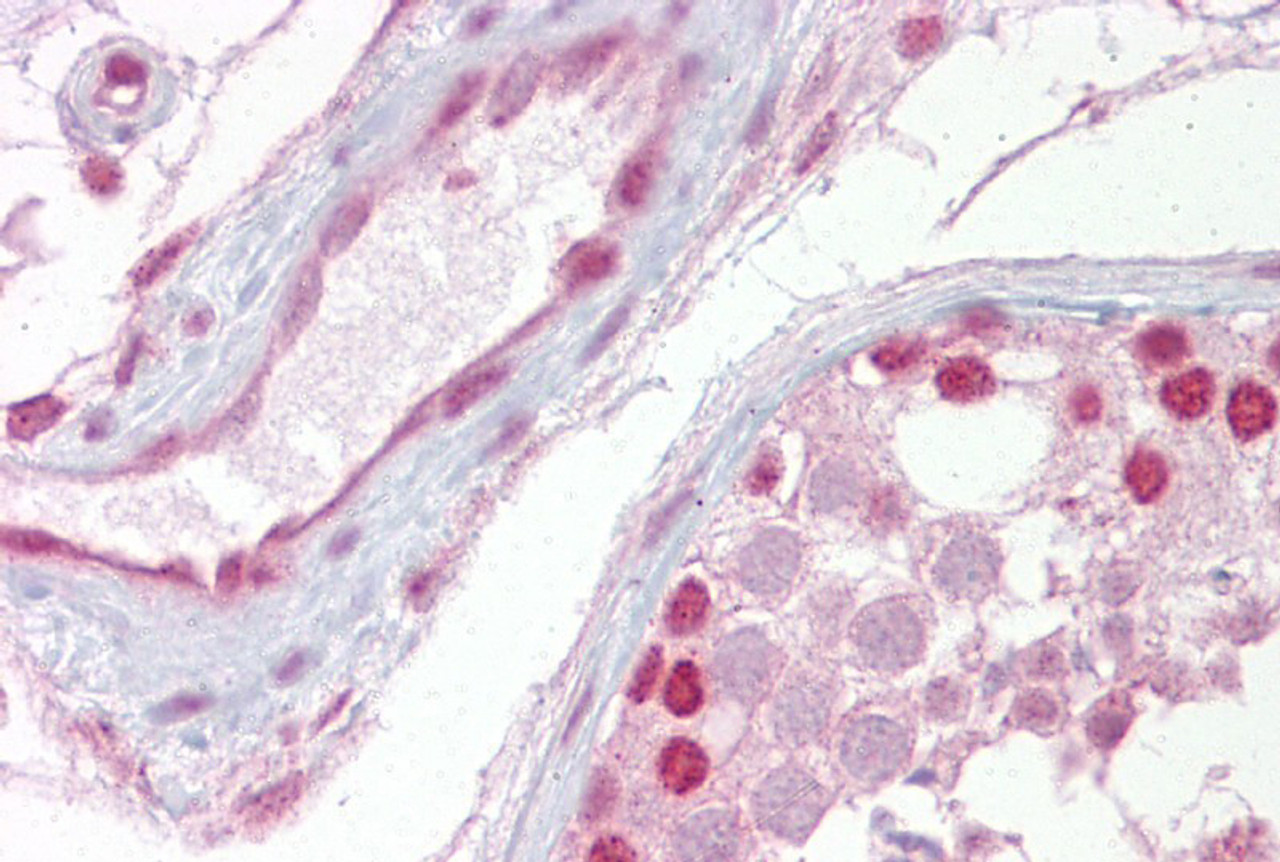 Antibody used in IHC on Human Testis.