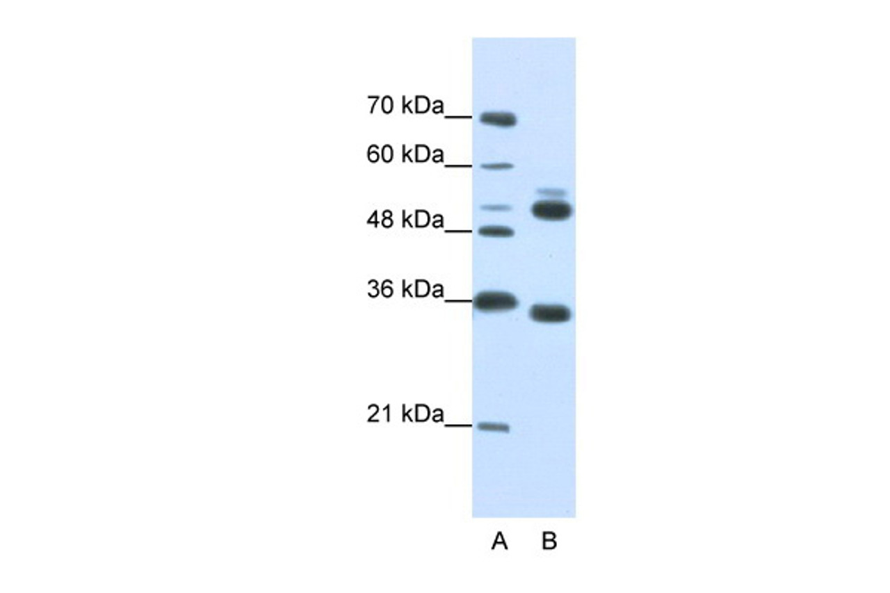 Antibody used in WB on Human Jurkat 0.2-1 ug/ml.