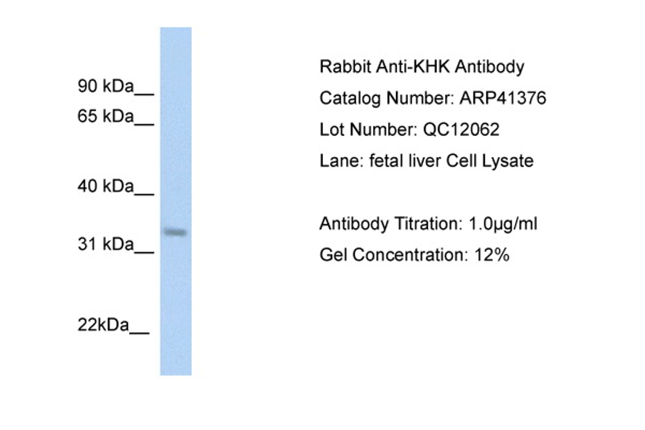 Antibody used in WB on Human Fetal Liver at 1 ug/ml.