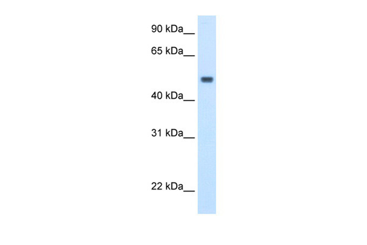 Antibody used in WB on Human Liver at 2.5 ug/ml.