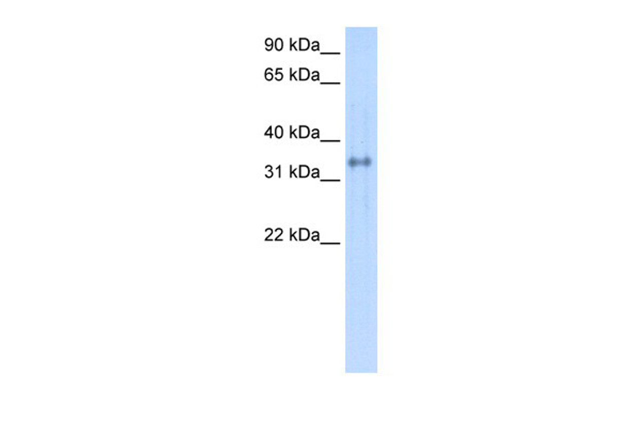 Antibody used in WB on Human Lung at 0.2-1 ug/ml.