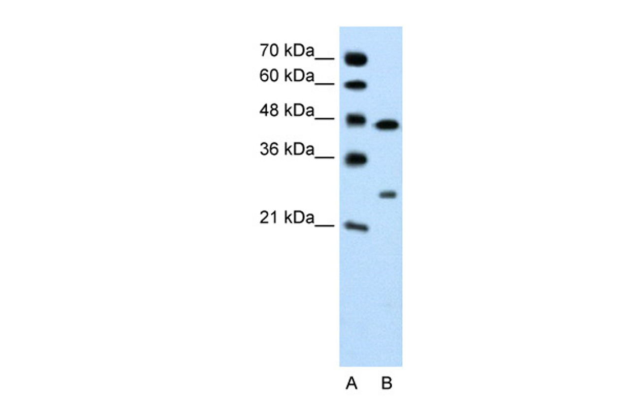 Antibody used in WB on Jurkat 0.2-1 ug/ml.