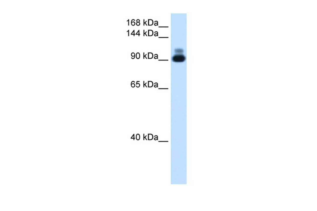 Antibody used in WB on Human heart at 1.25 ug/ml.