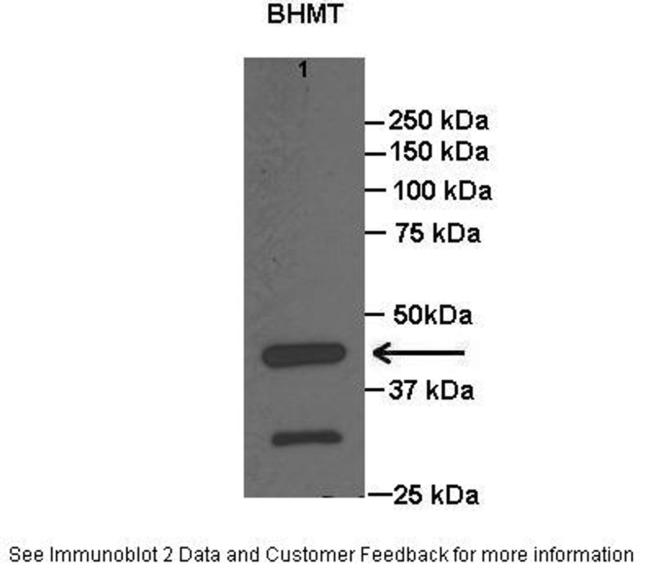 Antibody used in WB on Rat liver at: 1:1000.