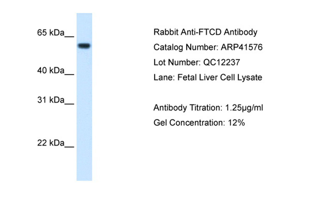 Antibody used in WB on Human Fetal Liver at 1.25 ug/ml.