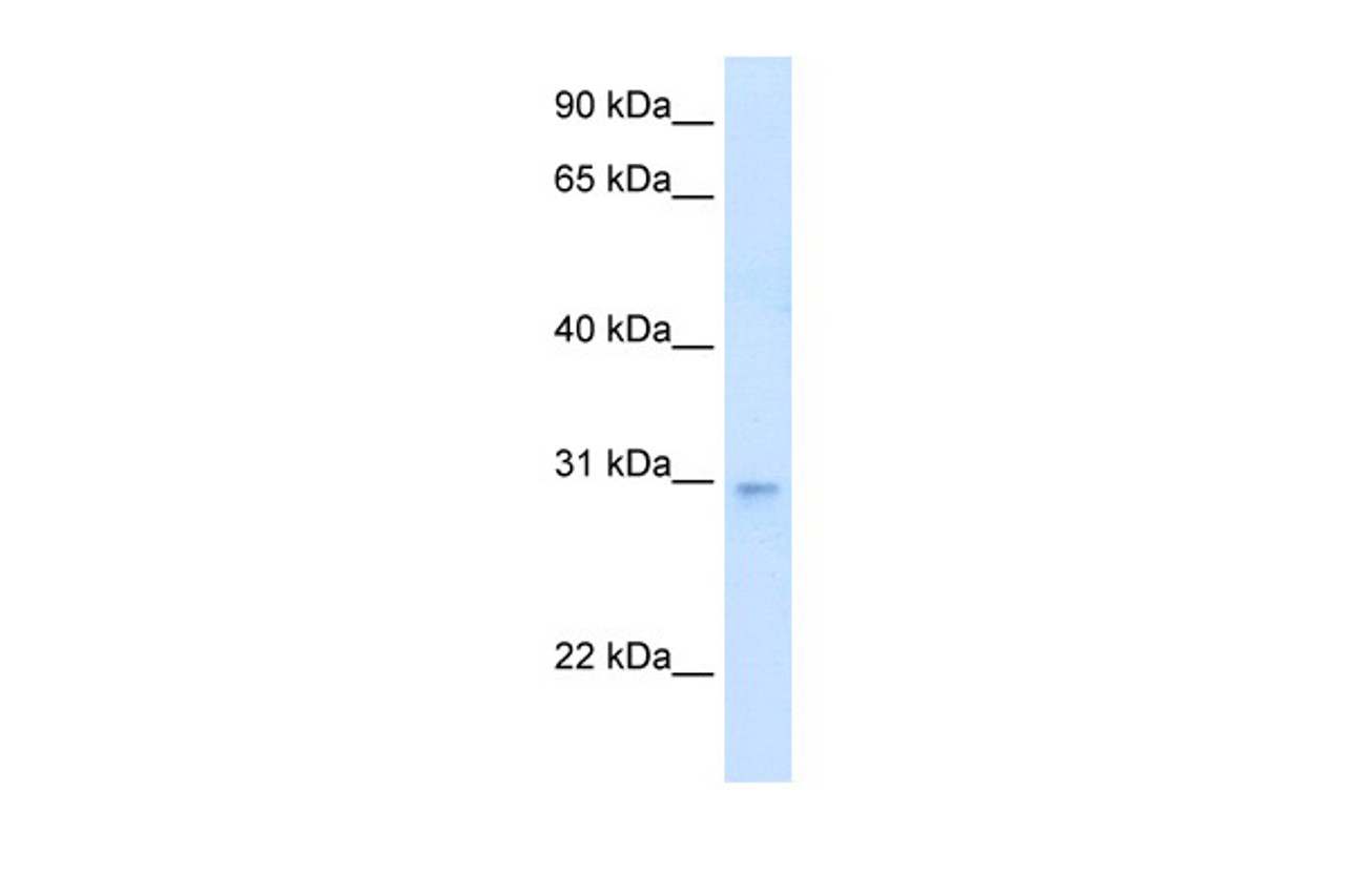 Antibody used in WB on Human Heart at 0.625 ug/ml.