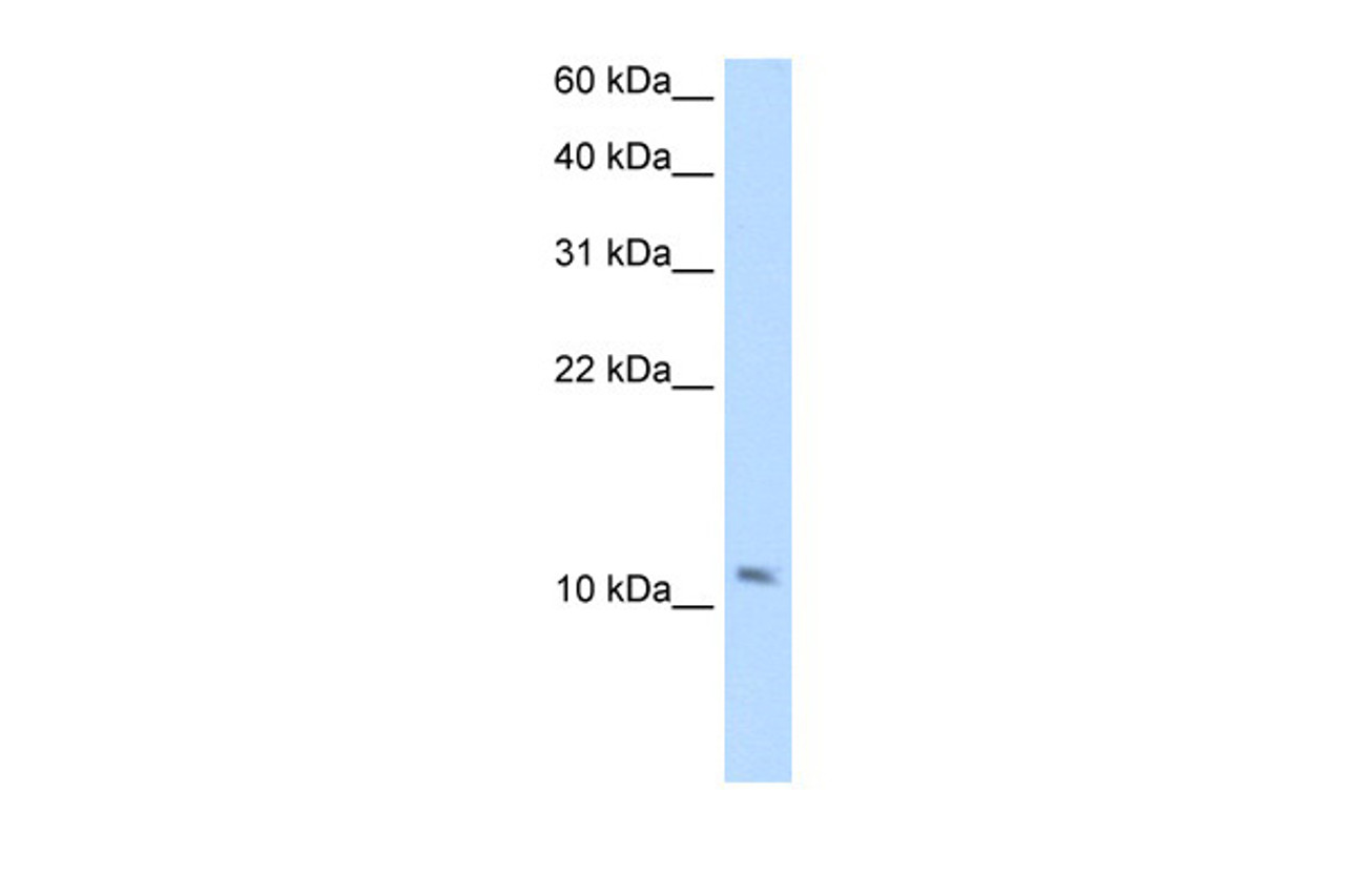 Antibody used in WB on Human Muscle at 2.5 ug/ml.