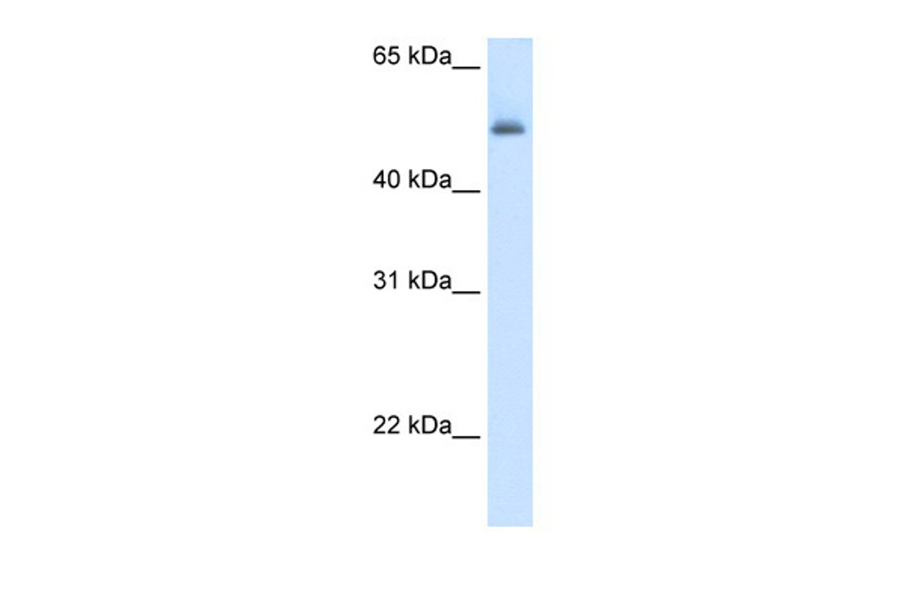 Antibody used in WB on Human Liver at 5.0 ug/ml.
