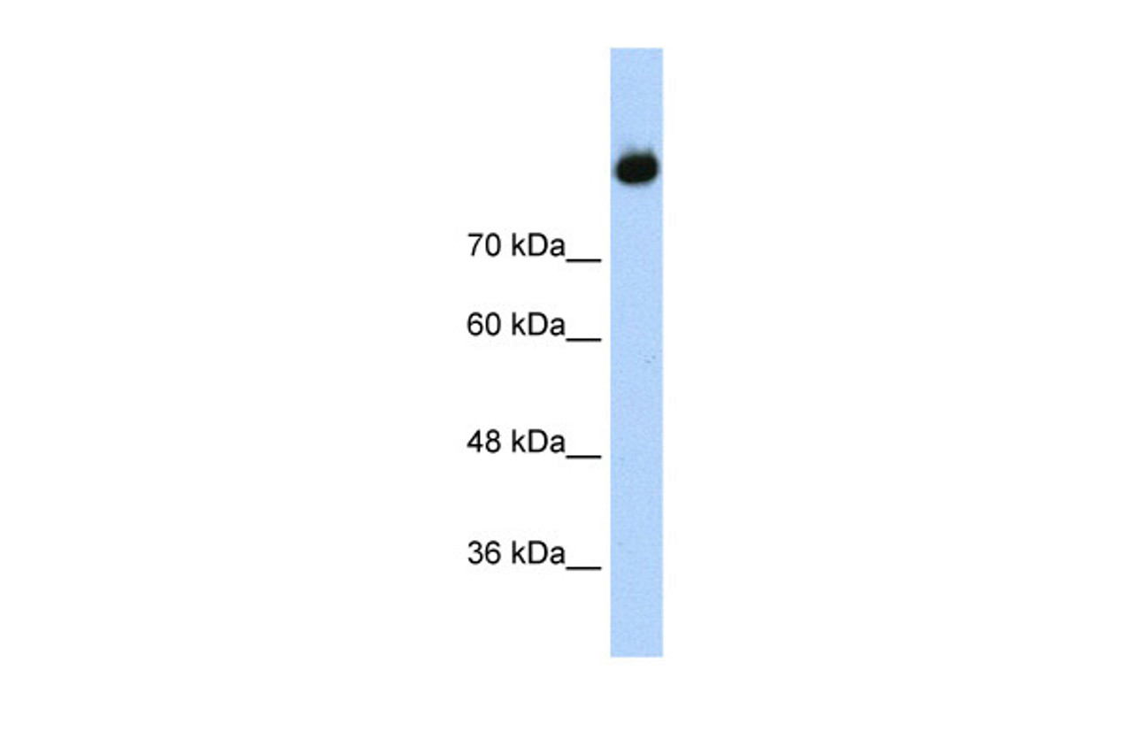 Antibody used in WB on Human Jurkat 1.25 ug/ml.