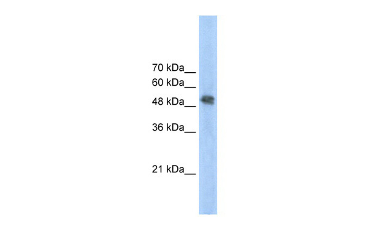 Antibody used in WB on Human Jurkat cells at 2.5 ug/ml.