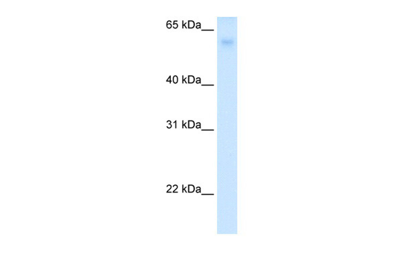 Antibody used in WB on Human Liver at 0.2-1 ug/ml.