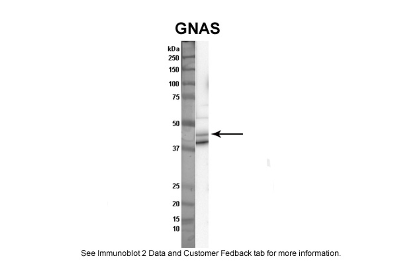Antibody used in WB on human thryoid at 1:1000.