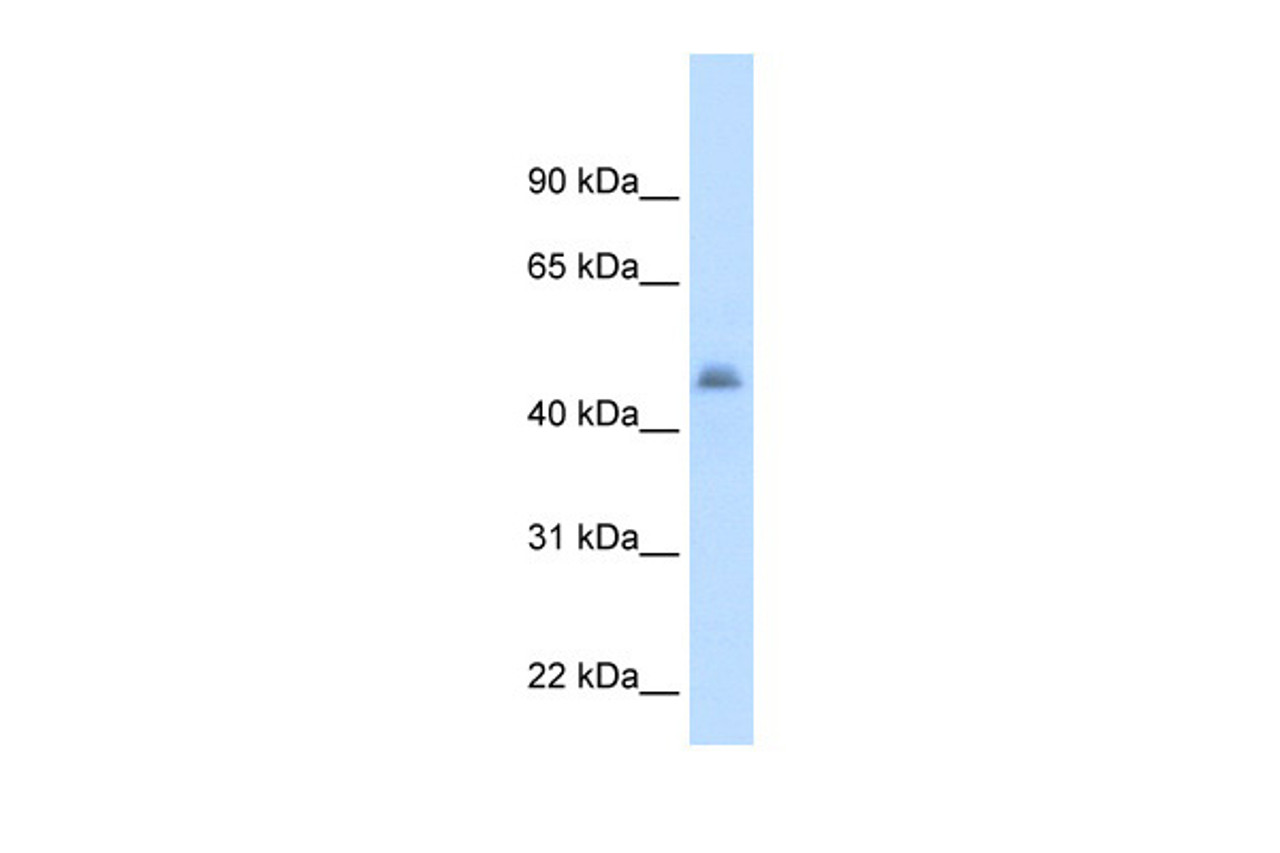 Antibody used in WB on Human Liver at 2.5 ug/ml.