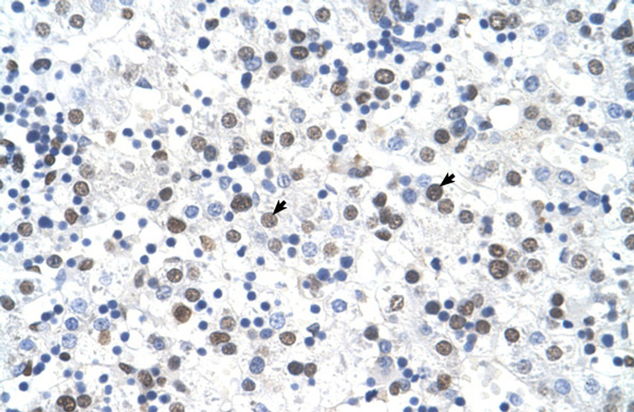 Antibody used in IHC on Human Liver at 4.0-8.0 ug/ml.