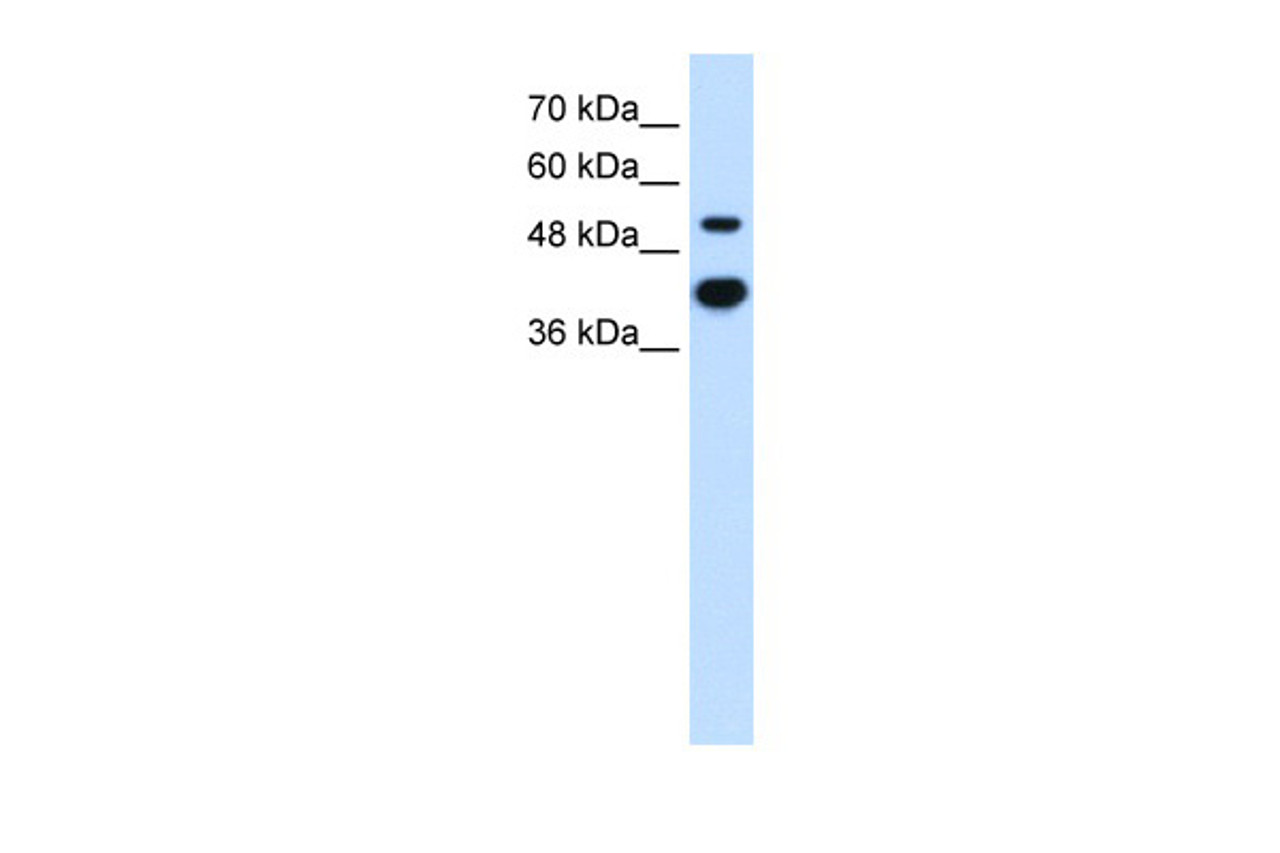 Antibody used in WB on Human HT1080 at 2.5 ug/ml.
