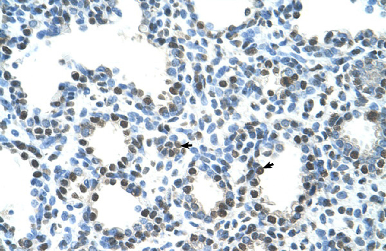 Antibody used in IHC on Human Lung at 4.0-8.0 ug/ml.