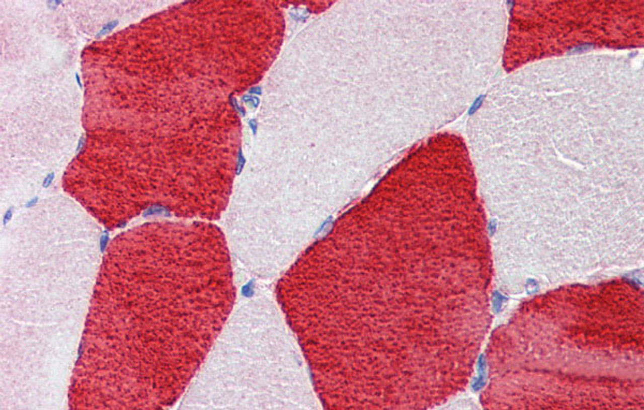 Antibody used in IHC on Human Skeletal Muscle at 5.0 ug/ml.