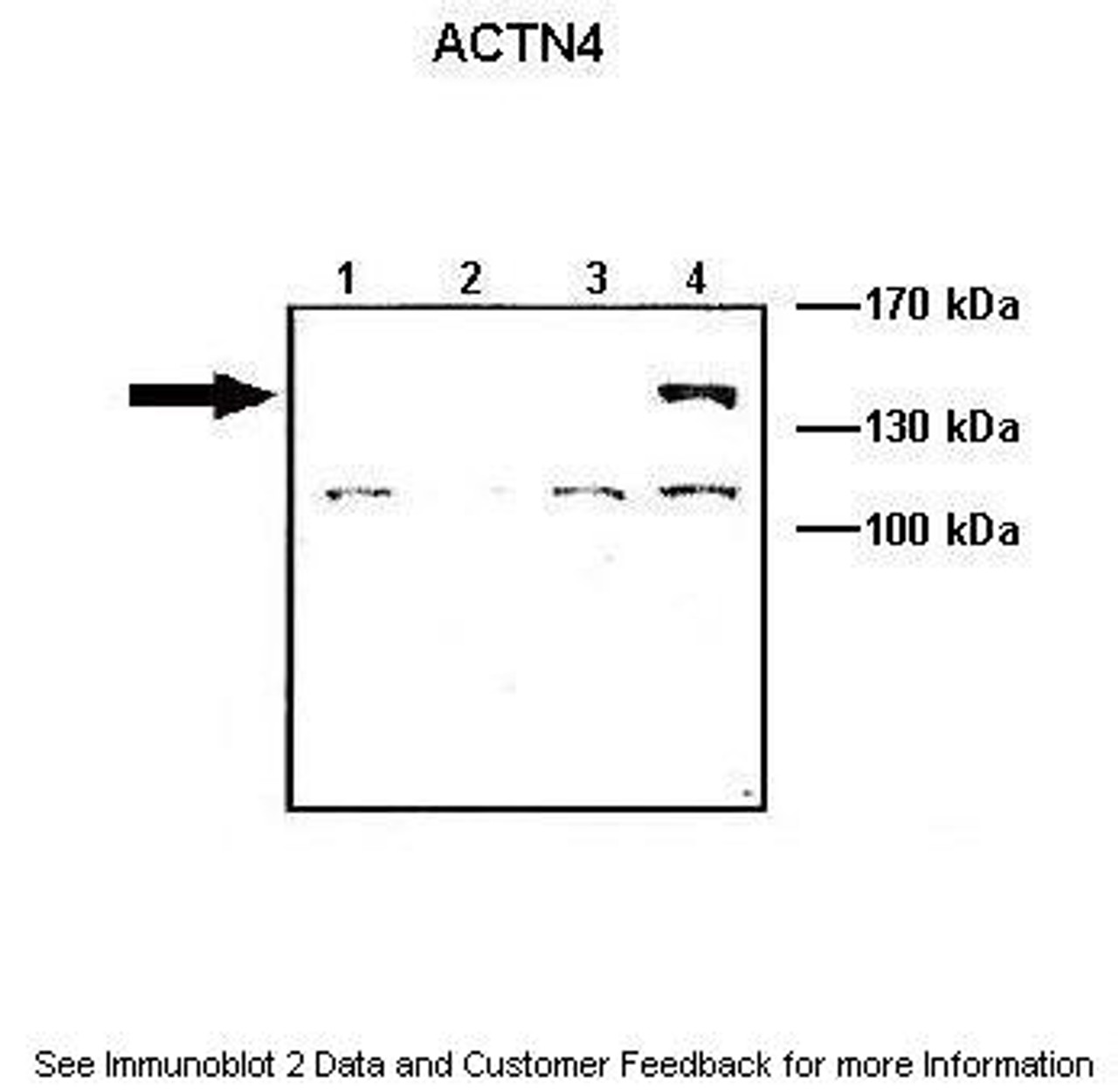 Antibody used in WB on ACTNX-GFP transfected at: 1:1000 (Lane1: 10 ug ACTN1-GFP transfected COS-7 lysate, Lane2: 10 ug ACTN2-GFP transfected COS-7 lysate, Lane3: 10 ug ACTN3-GFP transfected COS-7 lysate, Lane4: 10 ug ACTN4-GFP transfected COS-7 lysate) .