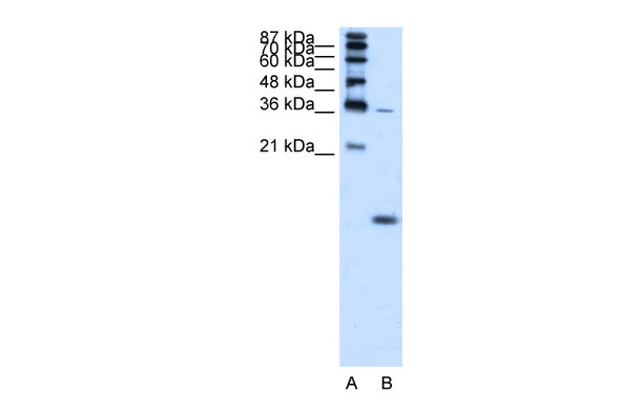 Antibody used in WB on Human K562 at 1.25 ug/ml.