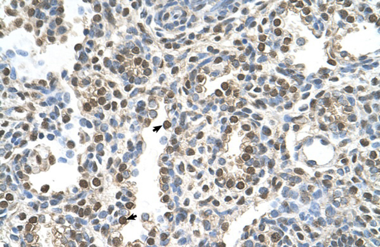 Antibody used in IHC on Human Lung at 4.0-8.0 ug/ml.