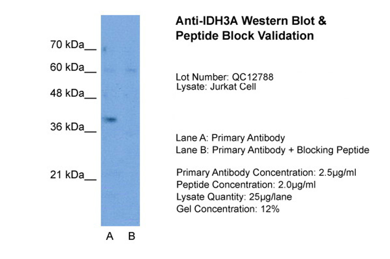 Antibody used in WB on Jurkat 2.5 ug/ml (Lane A: Primary Antibody and Lane B: Primary Antibody + Blocking Peptide ) .