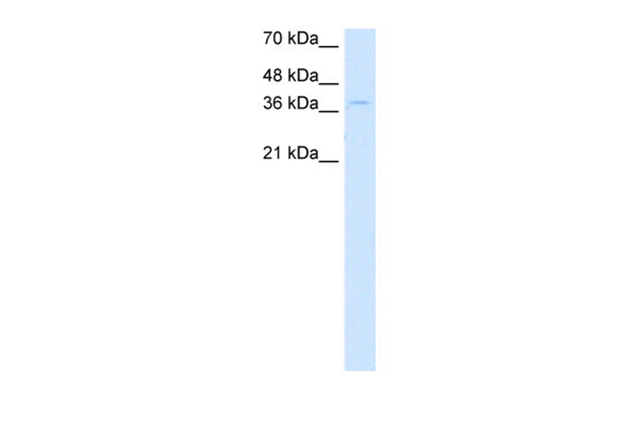 Antibody used in WB on Human DLD1 cells at 0.2-1 ug/ml.