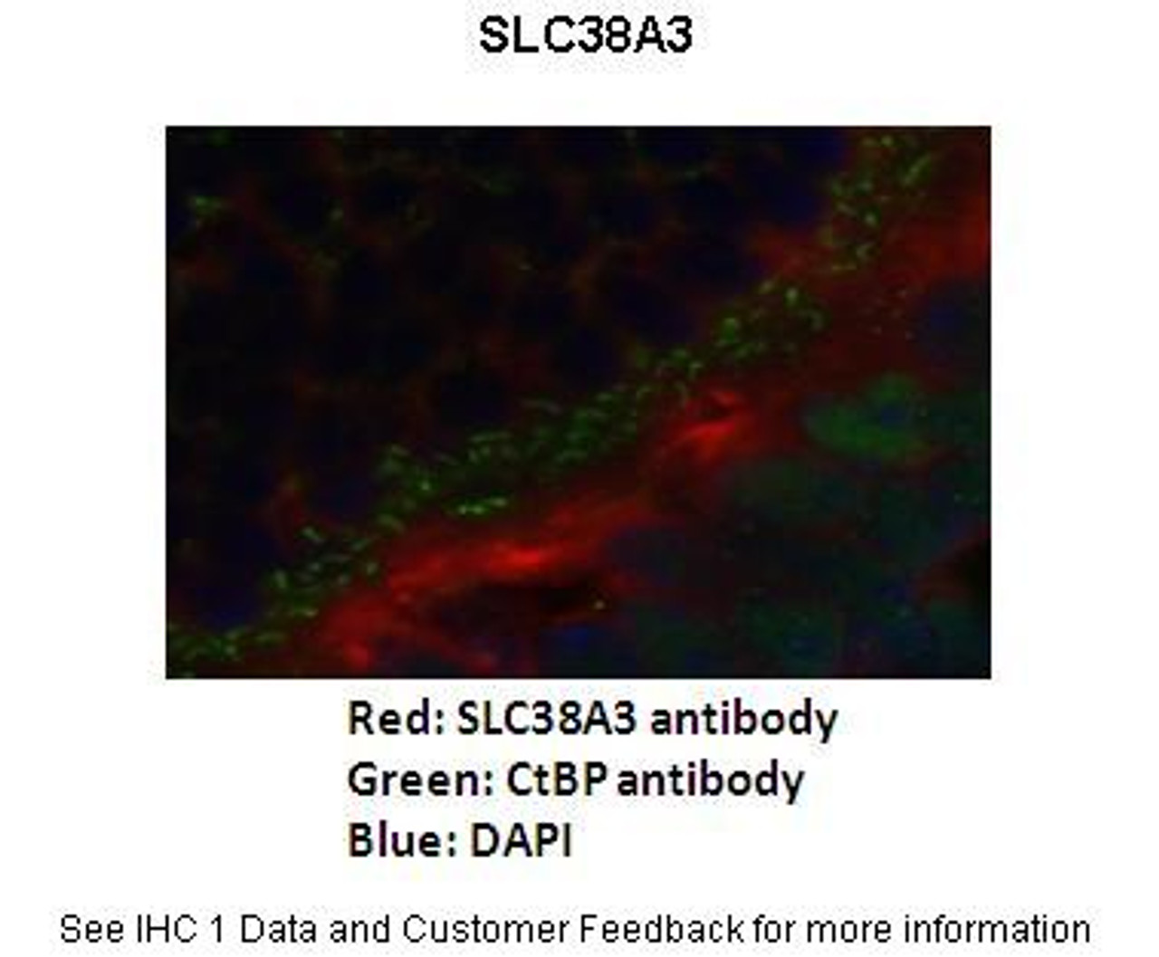 Antibody used in IHC on Mouse retina-outer plexiform layer at s 1:200.