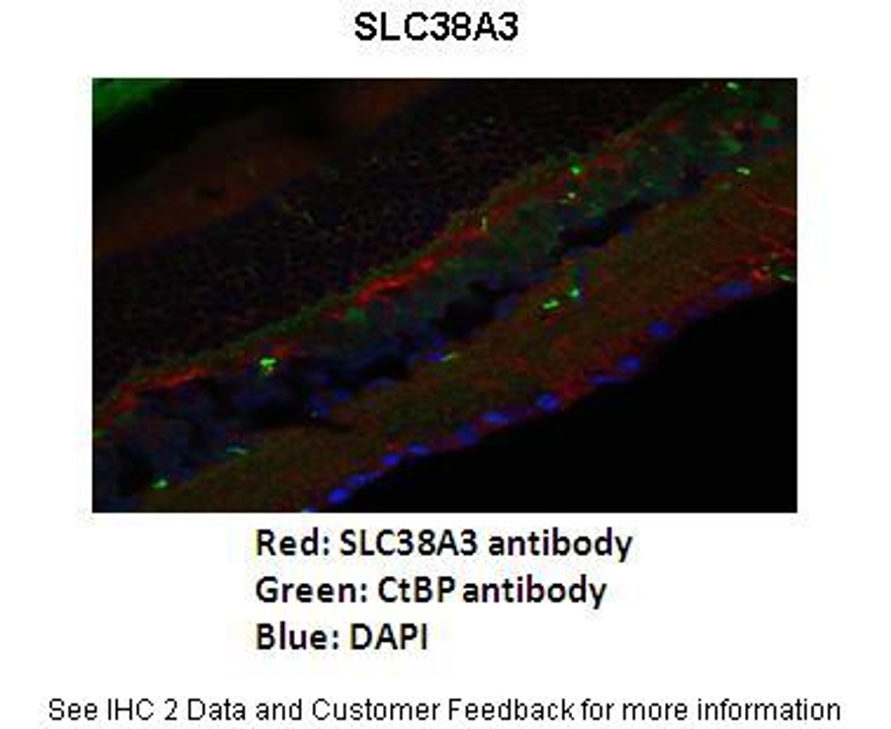 Antibody used in IHC on Mouse retina at s 1:200.